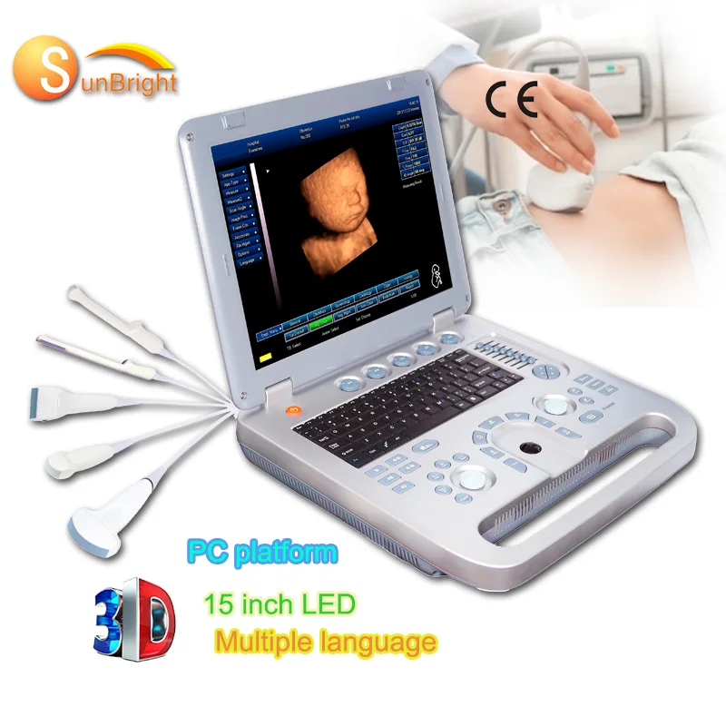 медицинский диагностический инструмент Sun-800D ультразвука сердца ноутбука 3D SunBright высокой эффективности 15 дюймов медицинский диагностический инструмент Sun-800D - 0