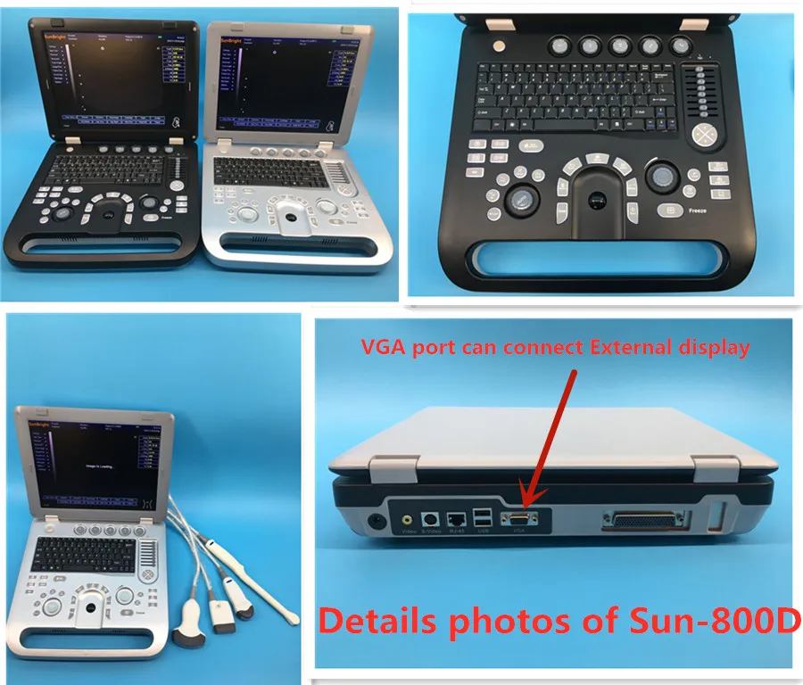 медицинский диагностический инструмент Sun-800D ультразвука сердца ноутбука 3D SunBright высокой эффективности 15 дюймов медицинский диагностический инструмент Sun-800D - 3