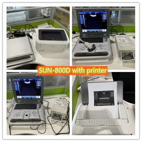 медицинский диагностический инструмент Sun-800D ультразвука сердца ноутбука 3D SunBright высокой эффективности 15 дюймов медицинский диагностический инструмент Sun-800D - 4